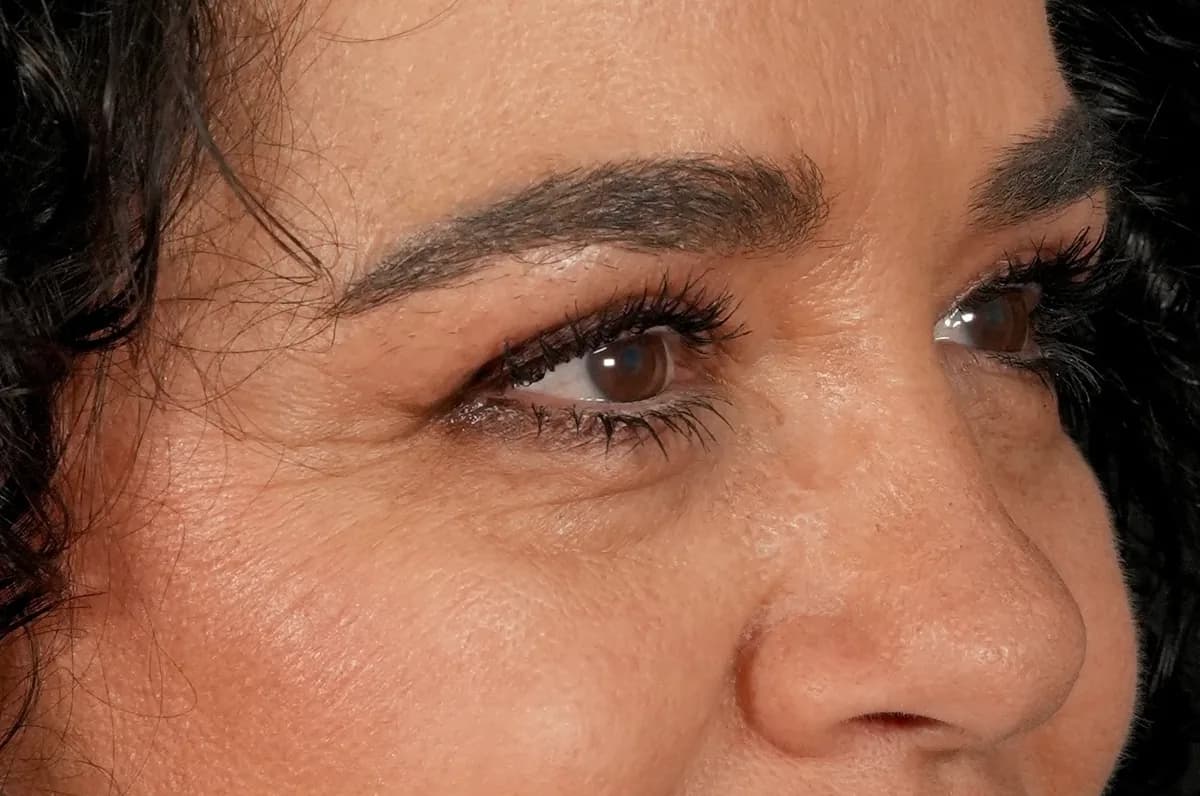 Mirada después de la blefaroplastia superior, más descansada y rejuvenecida