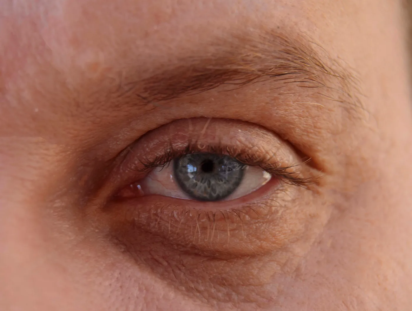 Detalle de la zona bajo los ojos, donde aparecen las bolsas y las ojeras