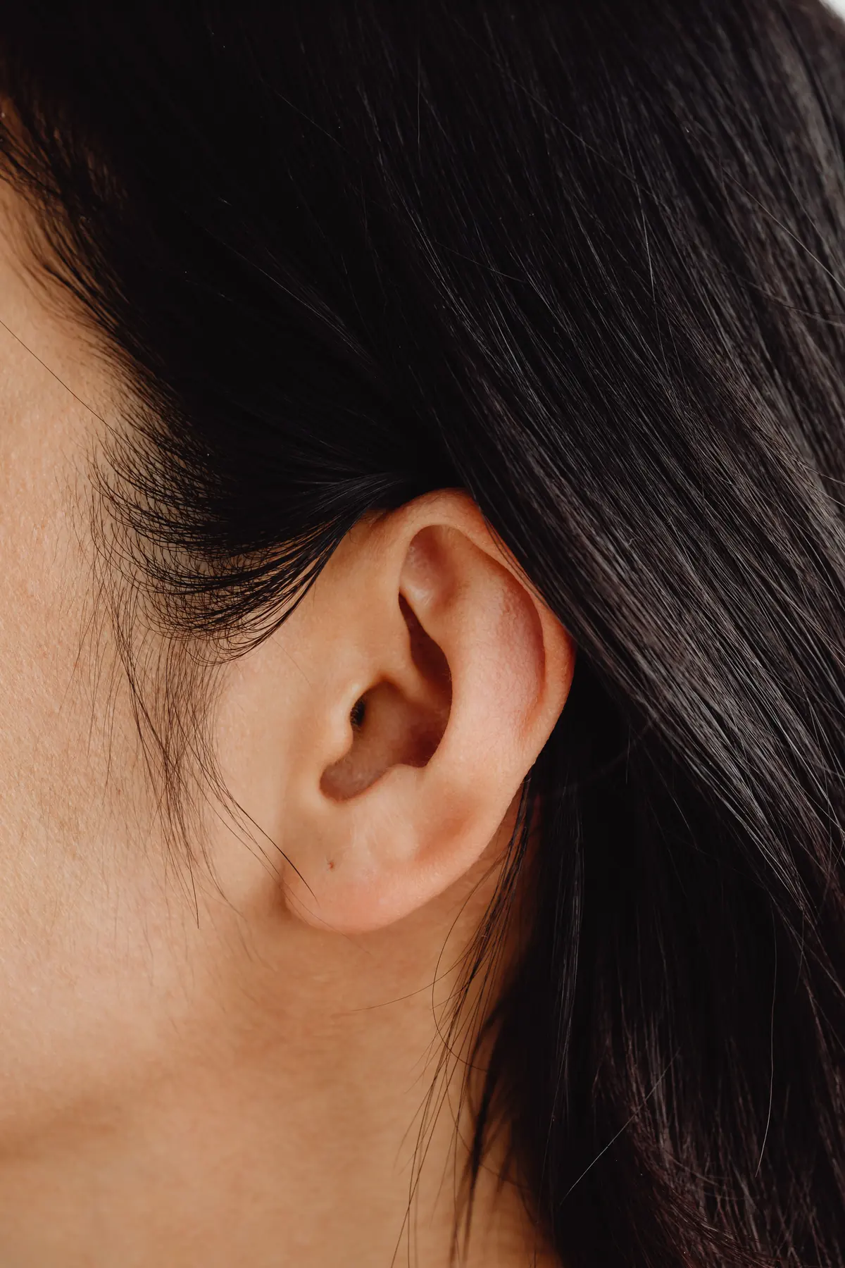Detalle de una oreja de perfil, la forma que busca la otoplastia